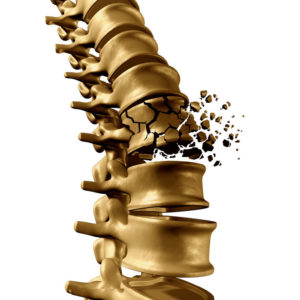 osteoporose