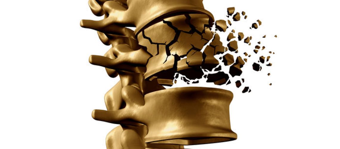 osteoporose